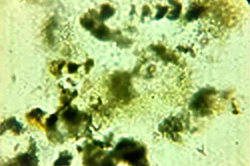 cianobacterias